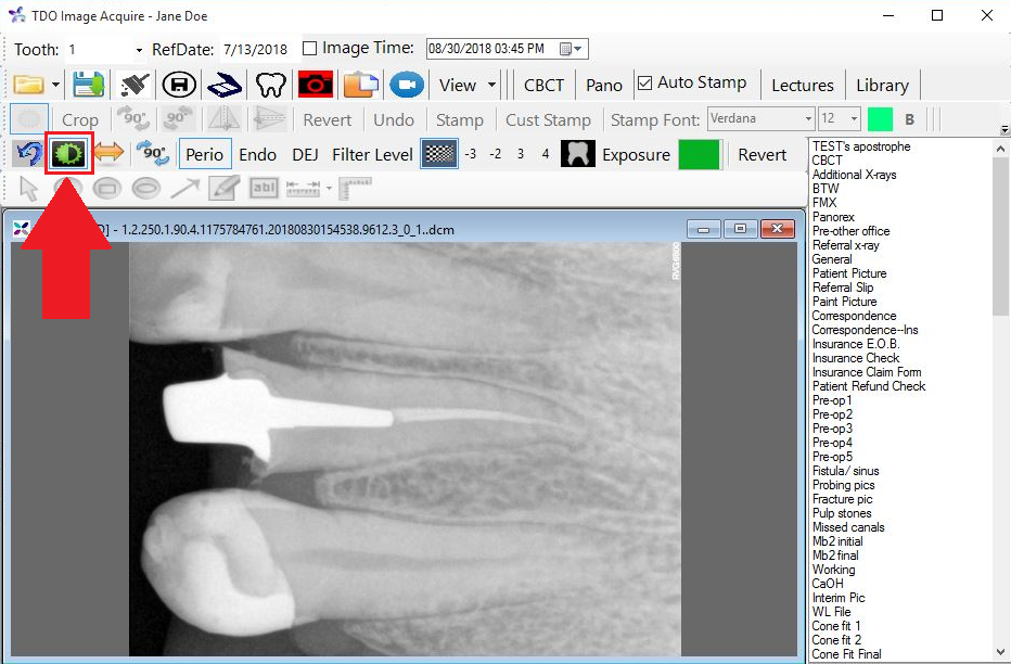 Configuring Carestream SDK and Troubleshooting Xray Image Quality in